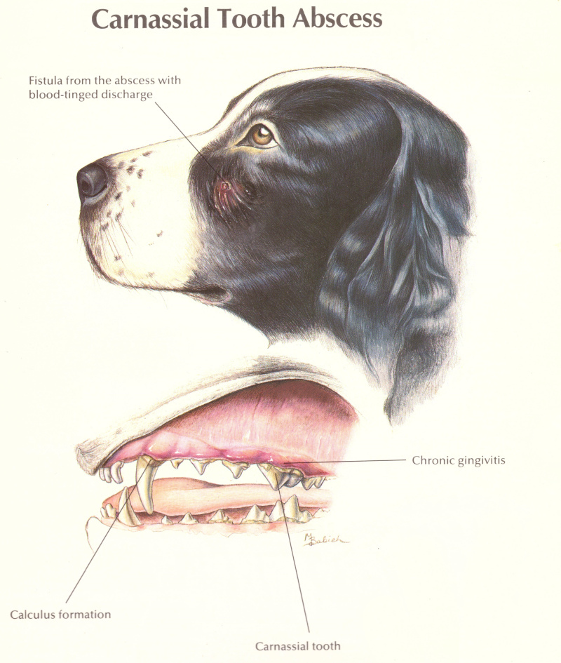 Drawing showing tooth abscess